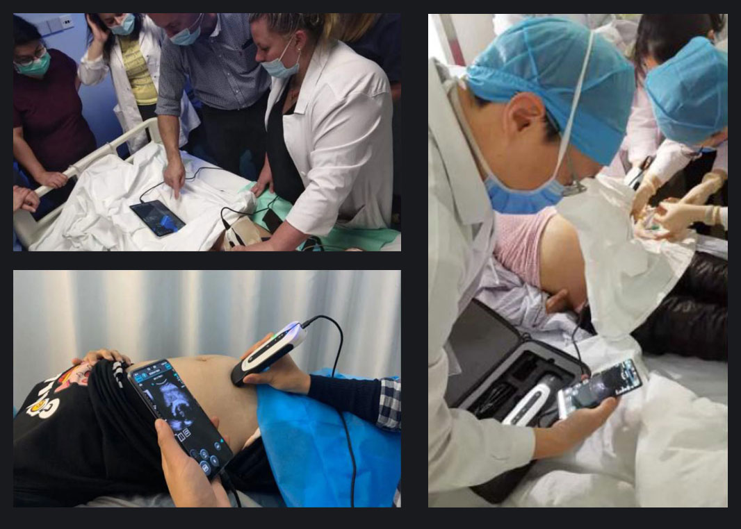 zoty��ŷ����ȫվ SonoEye ��Ը������ǿŮ�Խ�����