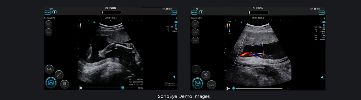 SonoEye �ڲ����е�Ӧ��