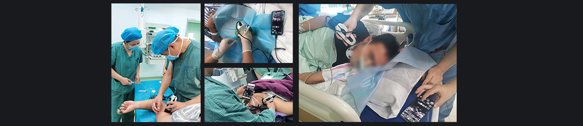 SonoEye �������е�Ӧ��