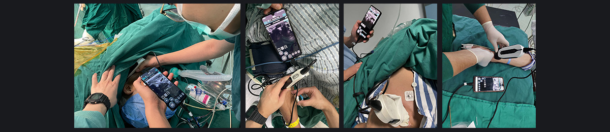 SonoEye �������е�Ӧ��