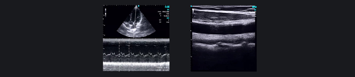 SonoEye �������е�Ӧ��