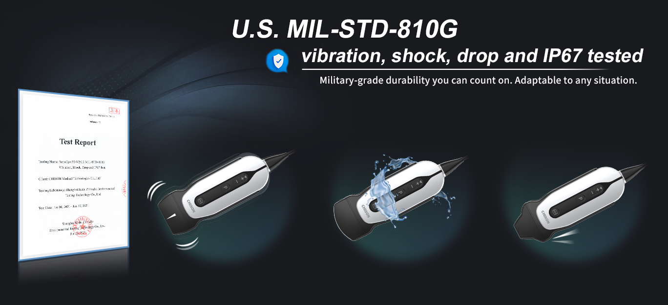 �� FIME 2024 ��̽�� SonoEye������ POCUS �ĸ߼��ֳ�ʽ����