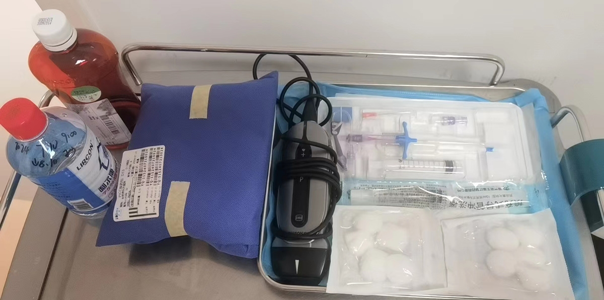 Enhancing Clinical Efficiency and Patient Safety with Handheld Ultrasound and Mini-Midline Catheters