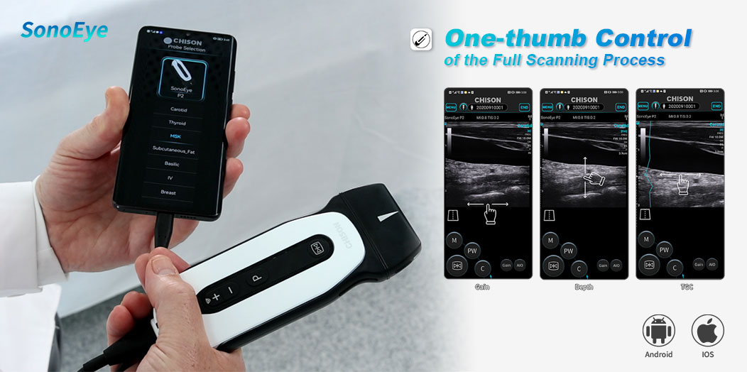 Authoritative Findings: SonoEye Hailed as Premier Ultrasound Device