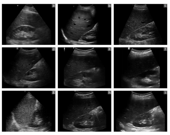 Authoritative Findings: SonoEye Hailed as Premier Ultrasound Device
