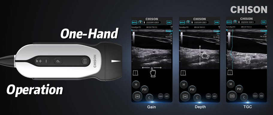 Mastering SonoEye: A Beginner's Guide to Portable Handheld Ultrasound for Clinical Efficiency