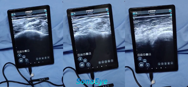 Empowering Remote Healthcare